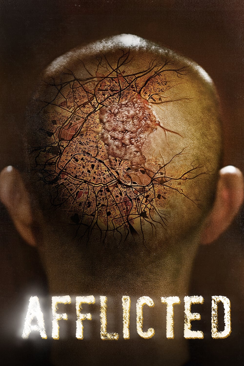 Afflicted: พิษรักเชื้อนรก